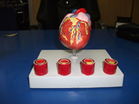 Heart With Arteries Pharmaceutical and Anatomical Model Gifts